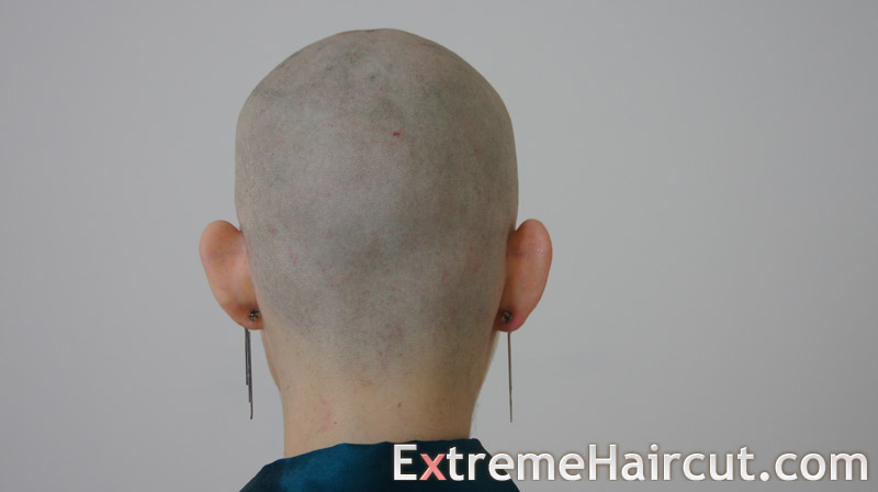 bald head and protruding ears